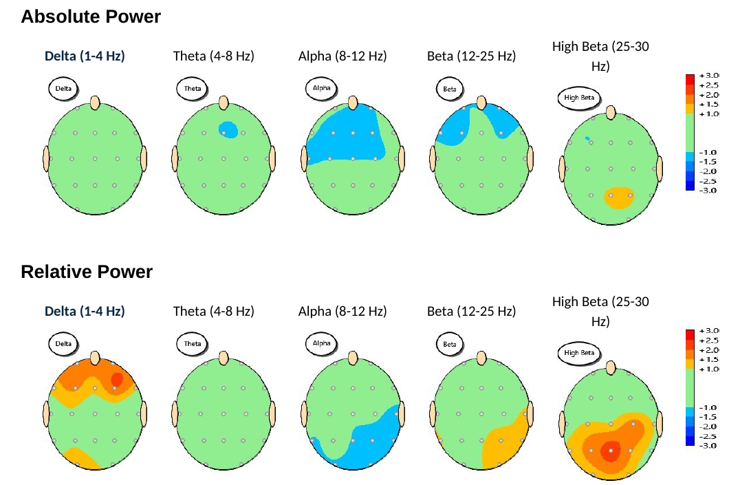 Example qEEG brain maps showing absolute and relative power across five frequency bands