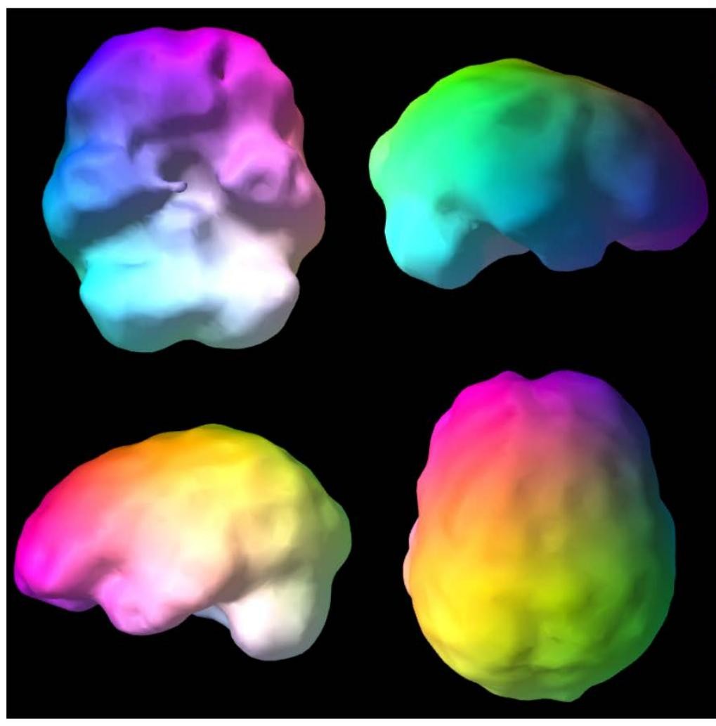 De-identified SPECT scan showing three-dimensional brain surface patterns