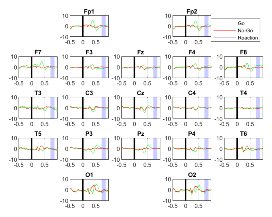Example ERP attention-task chart comparing Go and No-Go brain responses at each sensor